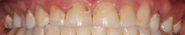 Cosmetic Dentistry Before Photo - Face